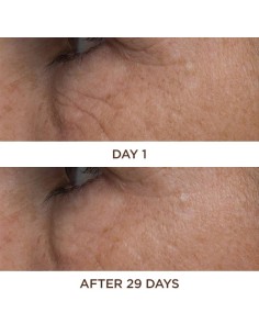 PERRICONE MD COLD PLASMA... 2