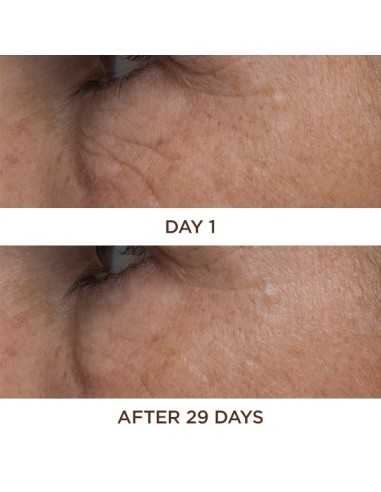 PERRICONE MD COLD PLASMA PLUS+ EYE 15ML