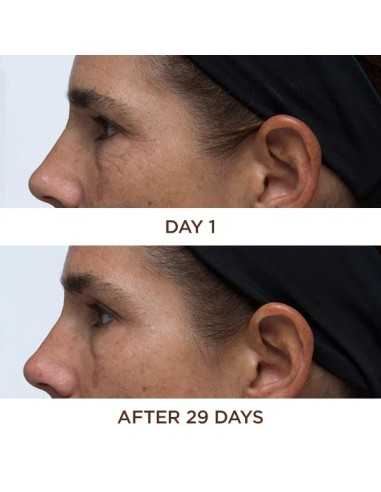 PERRICONE MD COLD PLASMA PLUS+ EYE 15ML
