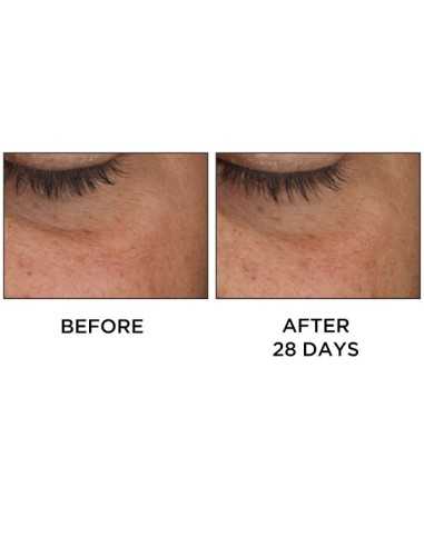 PERRICONE MD COLD PLASMA PLUS+ EYE 15ML
