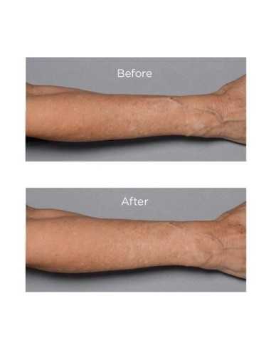PERRICONE MD COLD PLASMA PLUS+...