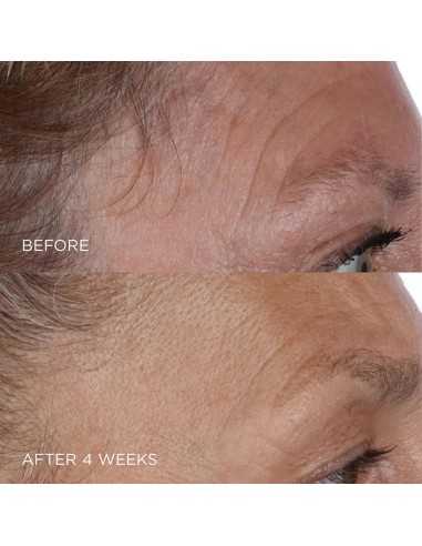 PERRICONE MD COLD PLASMA PLUS+ THE...