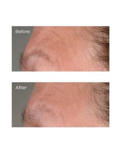 PERRICONE MD HIGH POTENCY GROWTH...