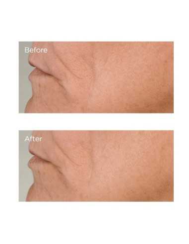 PERRICONE MD HIGH POTENCY GROWTH...