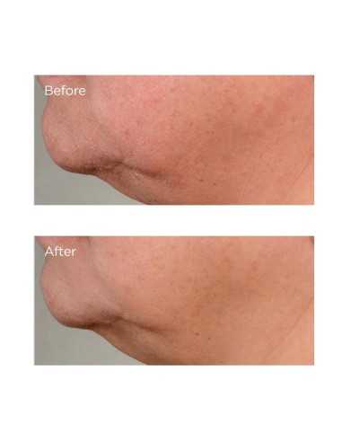 PERRICONE MD HIGH POTENCY GROWTH...