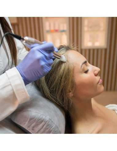 Capilar Microneedling frena la caía del cabello