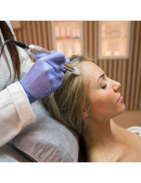 Capilar Microneedling frena la caía del cabello