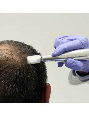 Capilar Microneedling frena la caía...