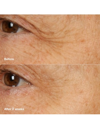 CLINIQUE SMART CLINICAL REPAIR...