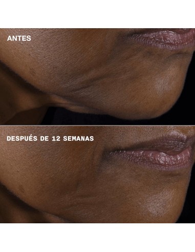 CLINIQUE SMART CLINICAL REPAIR...