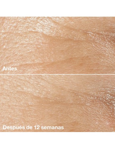 CLINIQUE SMART CLINICAL REPAIRWRINKLE...