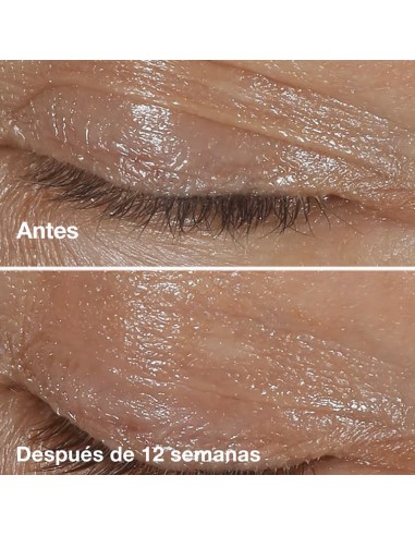 CLINIQUE SMART CLINICAL EYE 15 ML.