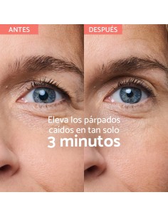 REMESCAR PARPADOS CAIDOS... 2