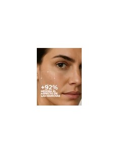 SEGLE CLEAR AZELAIC GEL... 2