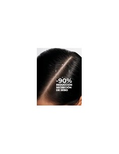 Segle Hair Scalp... 2