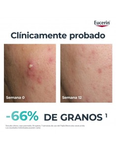 EUCERIN DERMOPURE CLINICAL TRIPLE ACTION 40ML 2