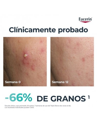 EUCERIN DERMOPURE CLINICAL TRIPLE ACTION 40ML