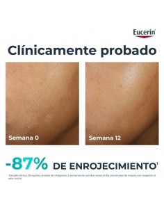 EUCERIN DERMOPURE CLINICAL HYDRA REPAIR 40ML 2